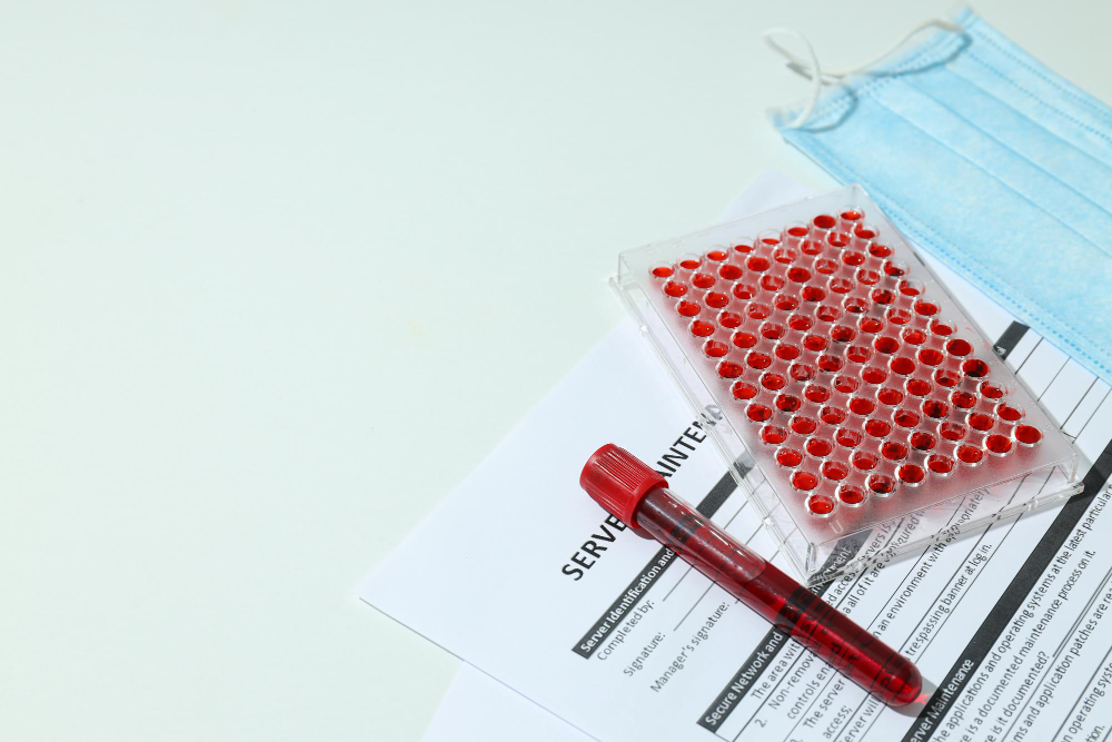 การอ่ารผลตรวจ HIV