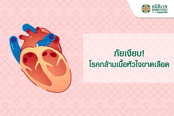 ภัยเงียบ! โรคกล้ามเนื้อหัวใจขาดเลือด