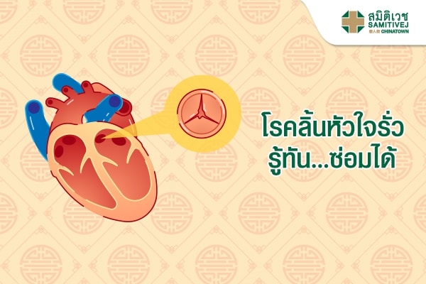 โรคลิ้นหัวใจรั่ว รู้ทัน...ซ่อมได้