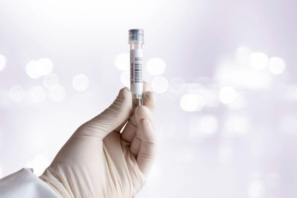 ชุดตรวจสุขภาพ Circle DNA ดีอย่างไร สามารถใช้บริการได้ที่ไหนบ้าง